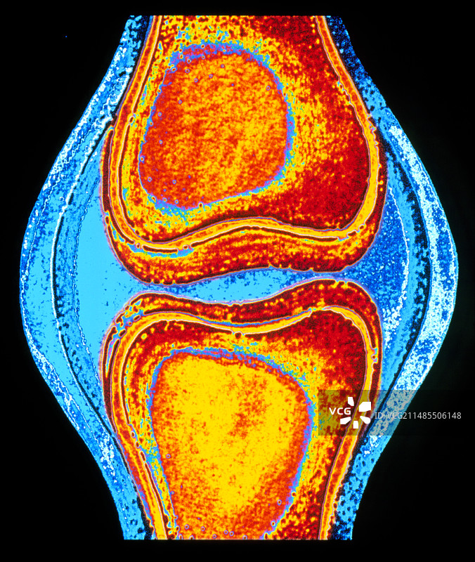 人膝关节的电脑艺术作品图片素材