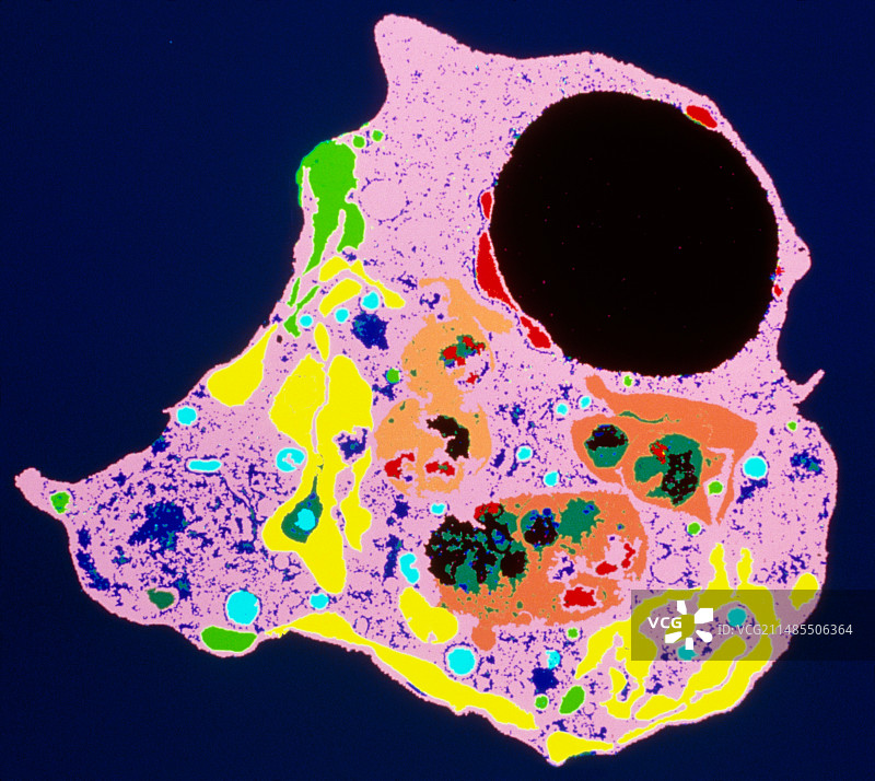 细胞凋亡期间白细胞的彩色透射电镜图像图片素材