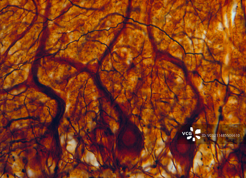 小脑浦肯野神经细胞光镜图图片素材