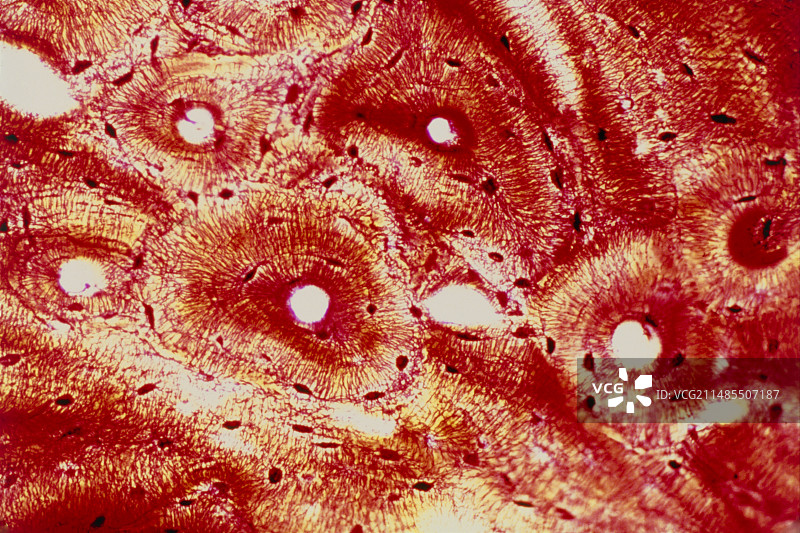 显示哈弗斯系统的致密骨光学显微镜图像图片素材