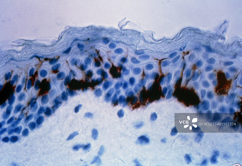 人造皮肤切片的光学显微镜图图片素材