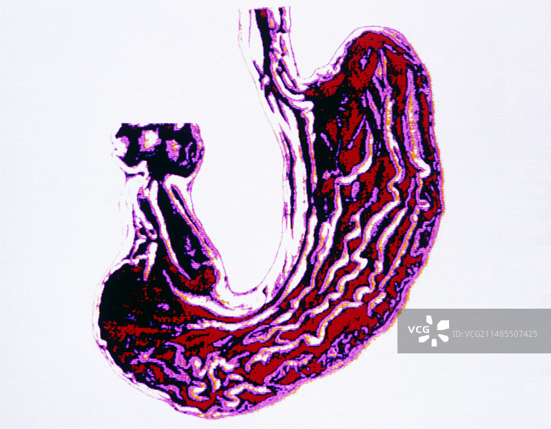 胃和下食道的电脑艺术作品图片素材