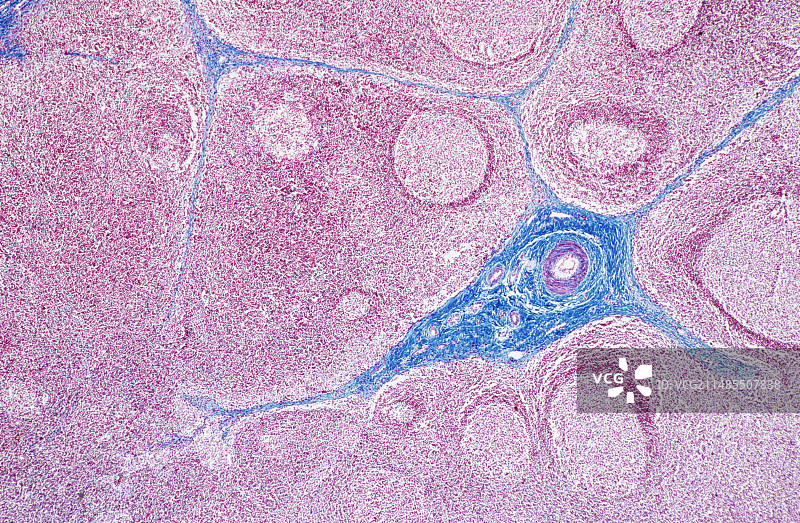 淋巴结显微照片图片素材