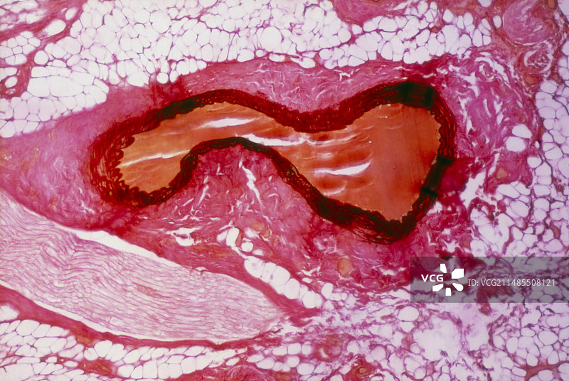 小动脉横截面的显微镜图像图片素材