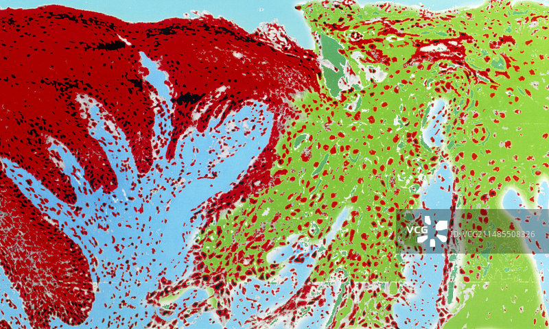 啮齿类溃疡切片的光学显微镜彩色图像图片素材