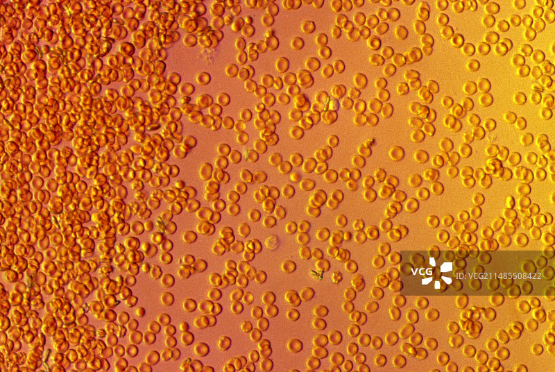 血涂片中红细胞的光学显微镜图像图片素材