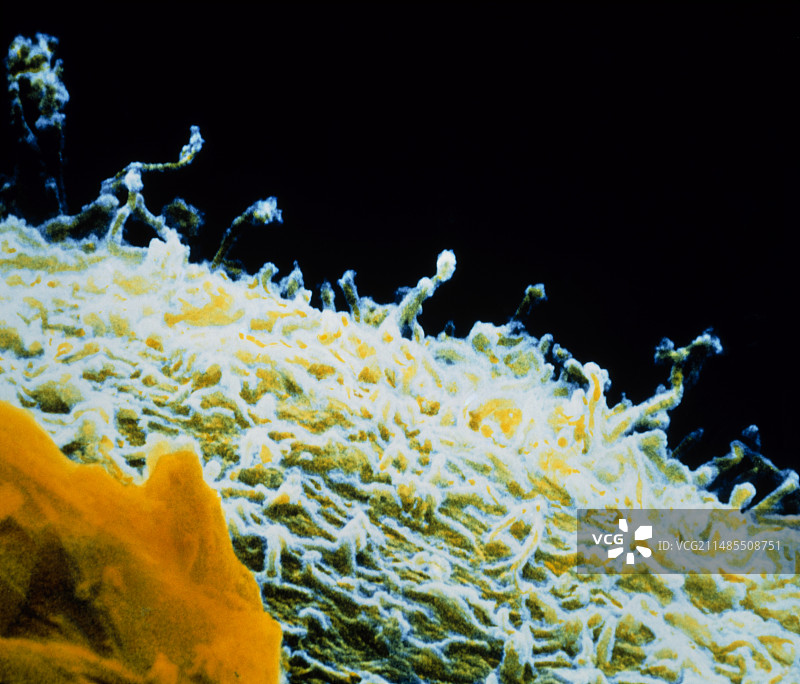 胚胎表面的微绒毛的彩色扫描电镜图图片素材