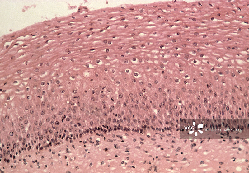 健康子宫颈上皮细胞切片的LM显微图像图片素材