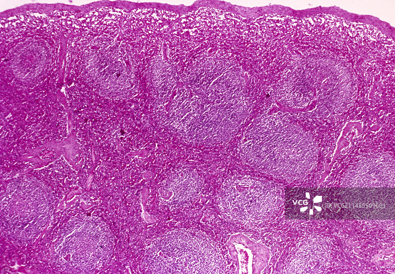 脾脏横截面的光学显微照片图片素材