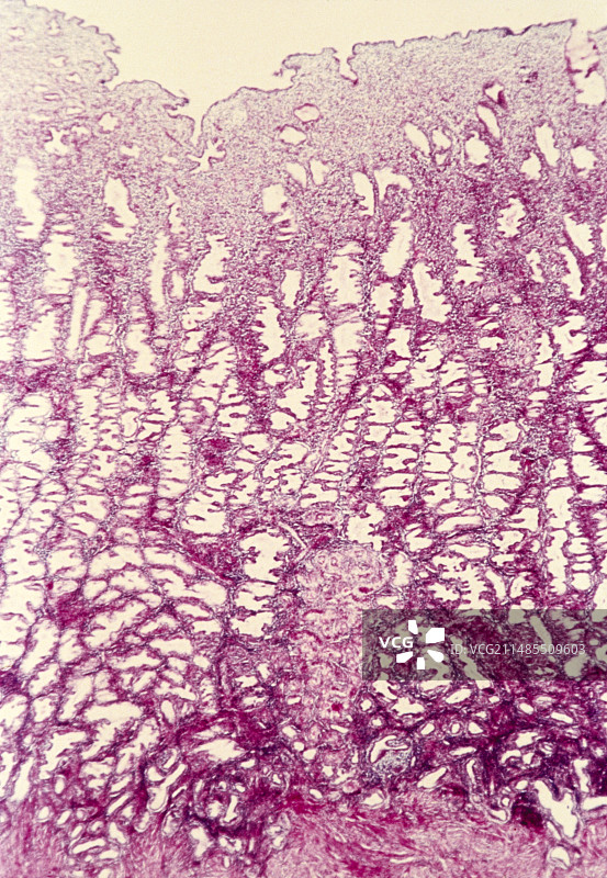 子宫切片（分泌期）的光学显微镜图像图片素材