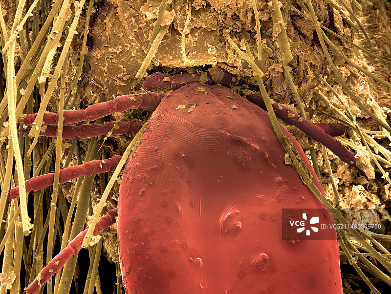 刺猬身上的蜱虫，扫描电镜图片素材