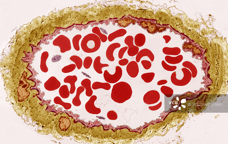 动脉，TEM图片素材