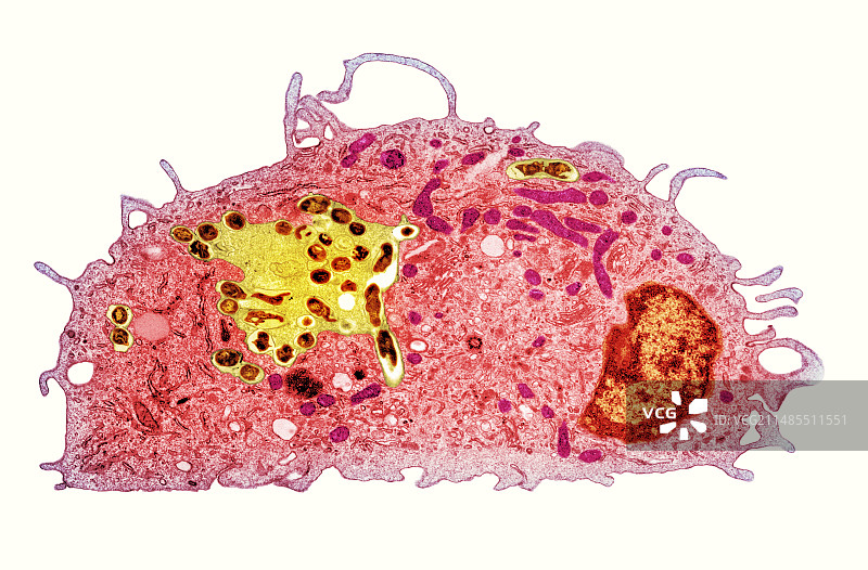 巨噬细胞和结核病疫苗，透射电子显微镜图片素材