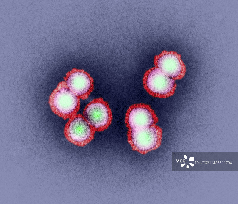 H5N1禽流感病毒颗粒（透射电镜）图片素材