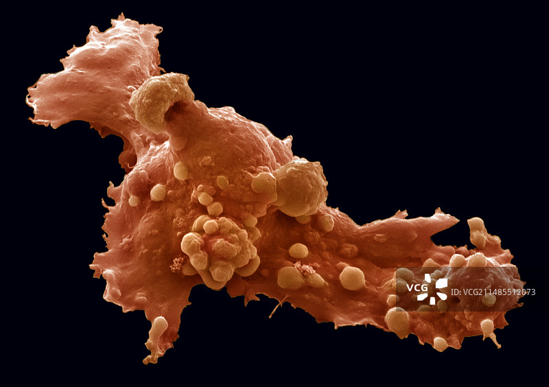 胚胎干细胞扫描电镜图图片素材