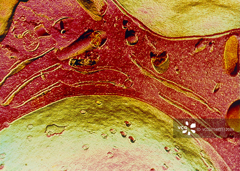 细胞核扫描电镜图图片素材