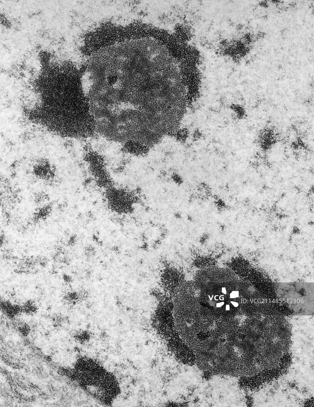 小鼠肝细胞中核仁的透射电镜照片图片素材