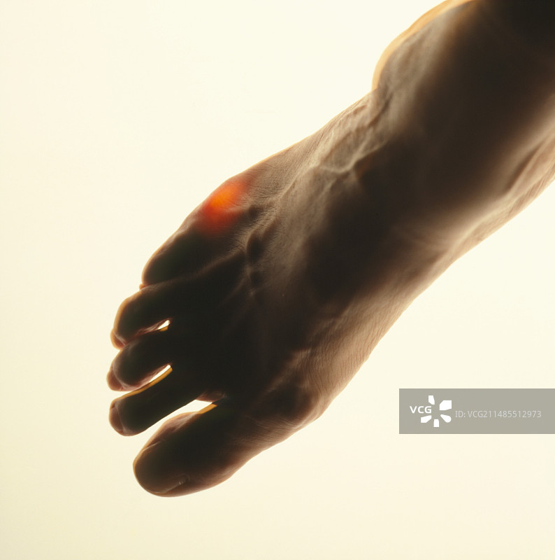 脚部抽象图：脚趾疼痛图片素材