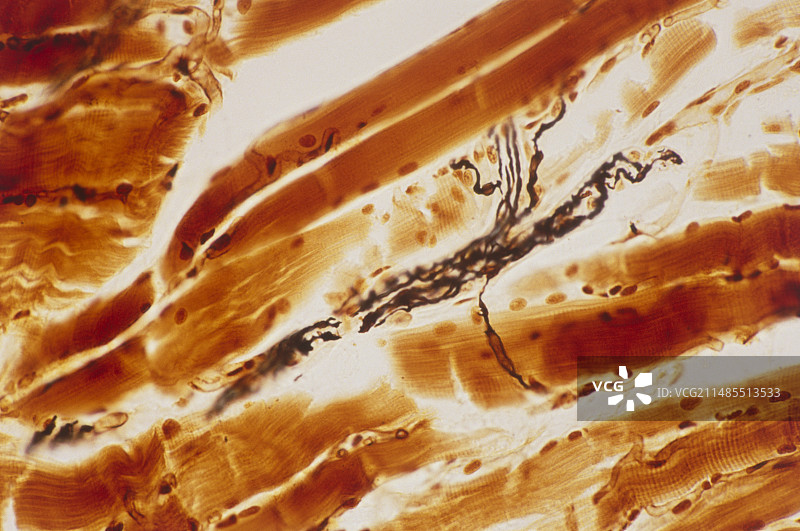 舌组织神经纤维光镜图图片素材