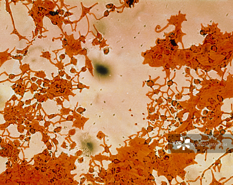 人卵放射冠细胞的彩色扫描电镜图图片素材