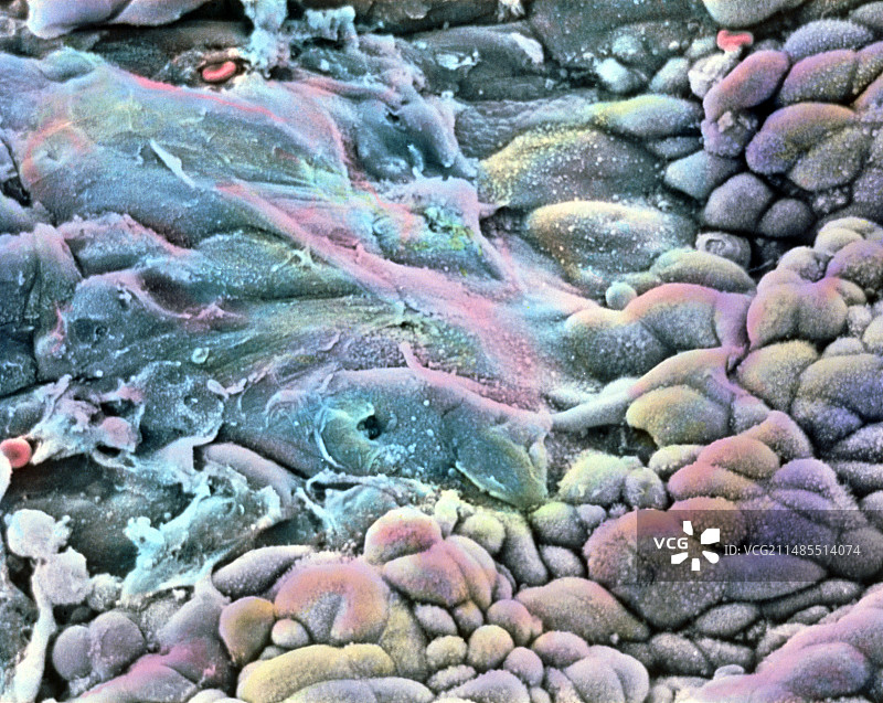 宫颈鳞状柱状上皮细胞的彩色扫描电镜图片素材