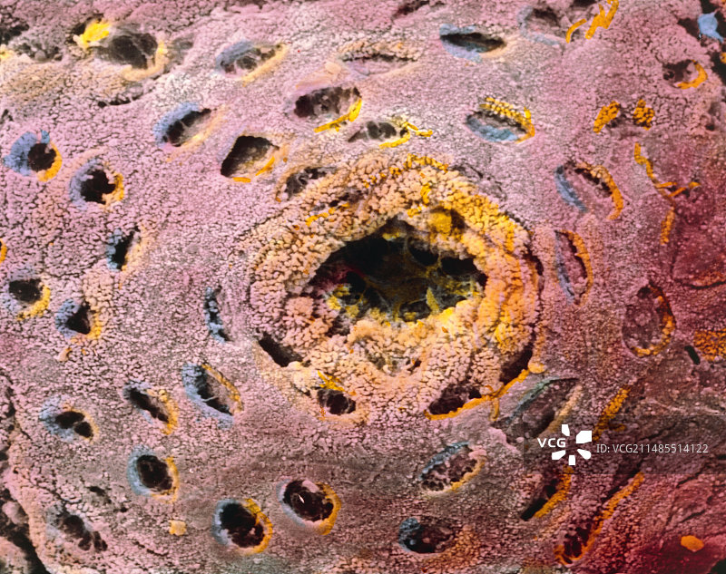 彩色扫描电镜下的人结肠腺体表面图片素材