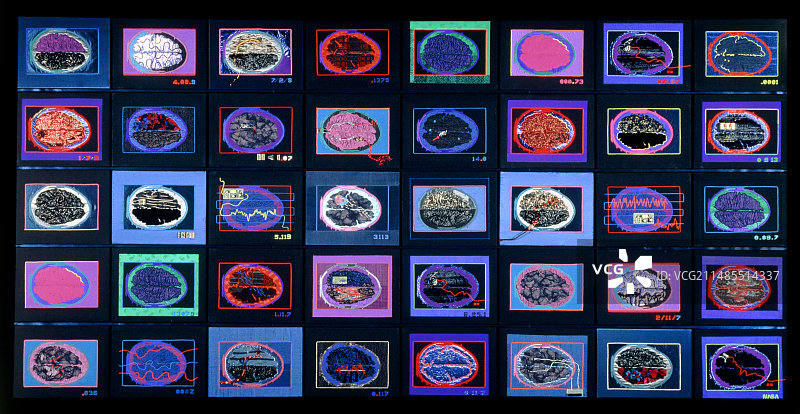 描绘40个脑部扫描的多媒体抽象艺术图片素材