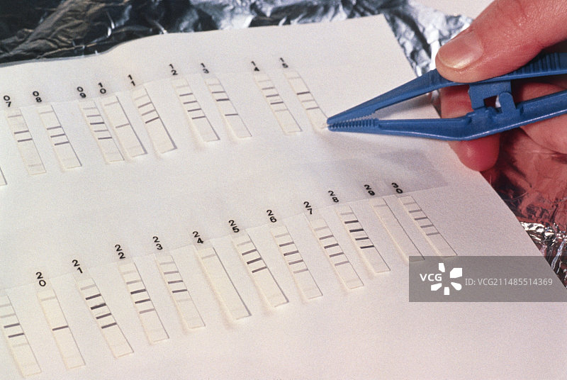 丙型肝炎病毒抗体的蛋白质印迹试验图片素材