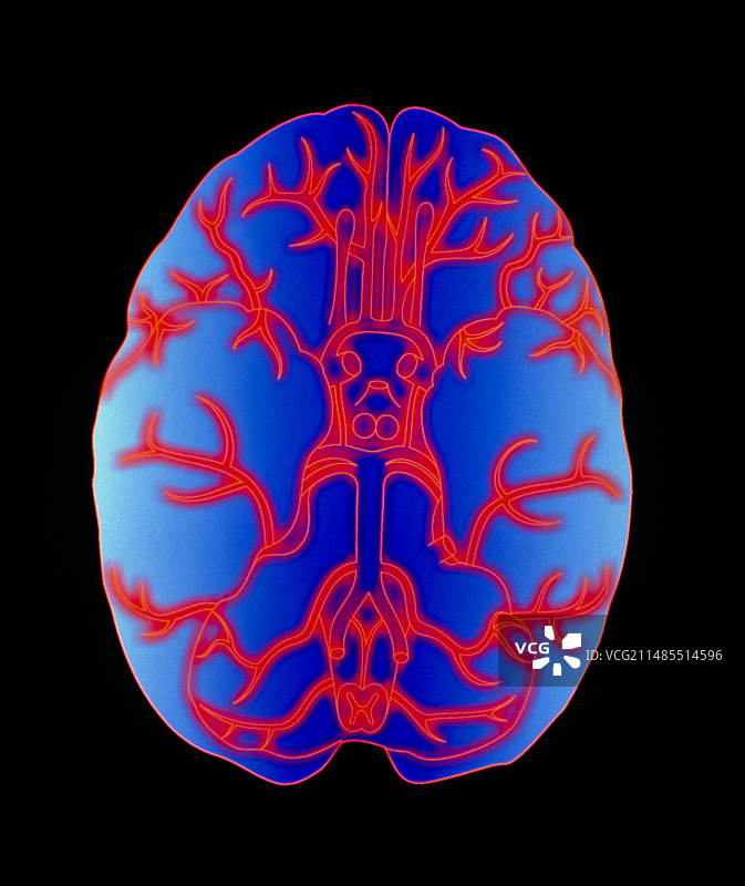 大脑基底动脉的计算机图形图片素材
