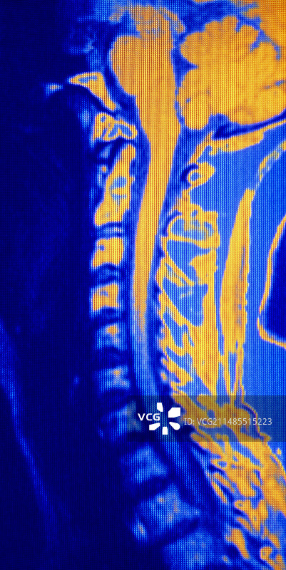 颈部区域的伪彩色核磁共振图像图片素材