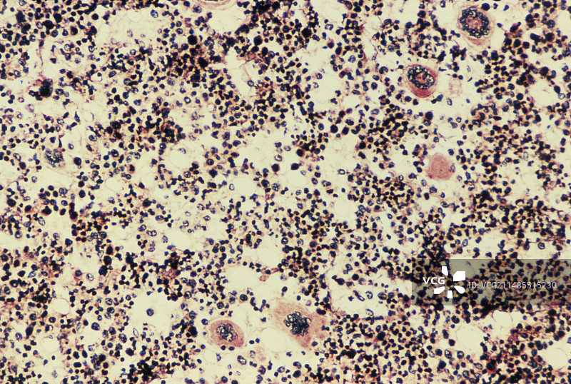在骨髓中观察到的发展中的血细胞图片素材