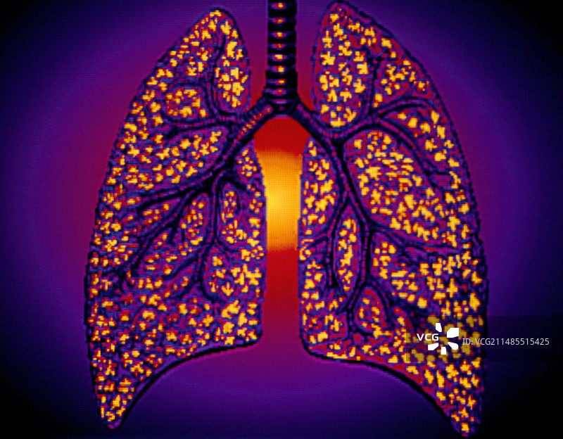 人类肺部、气管和细支气管插画图片素材