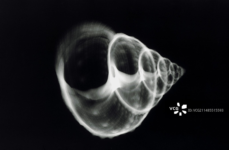 翁戎螺的X光片图片素材