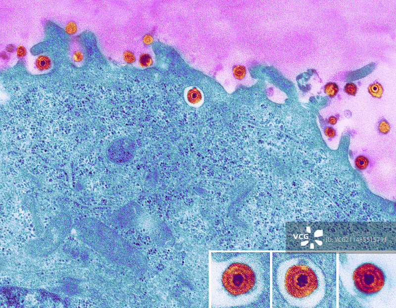 单纯疱疹病毒，透射电镜图图片素材