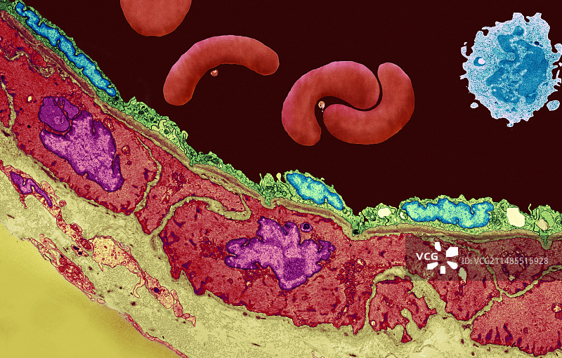 冠状动脉小动脉TEM图片素材