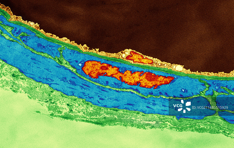 冠状动脉小动脉TEM图片素材