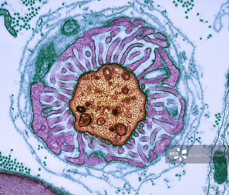 神经纤维结，TEM图片素材