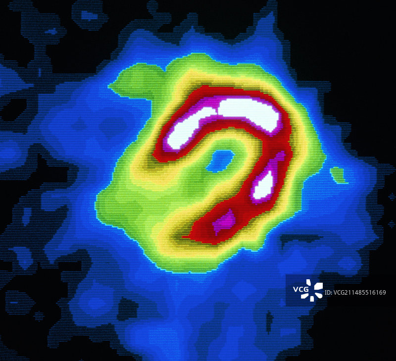 健康心肌的伽马扫描图片素材