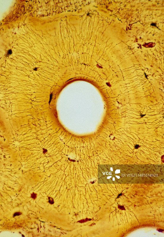 正常人密质骨显微照片图片素材