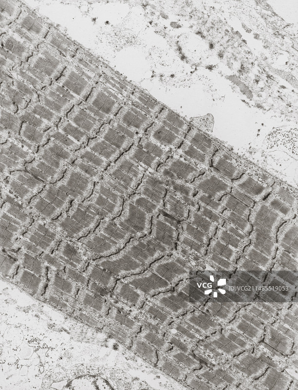 人体横纹骨骼肌TEM图片素材