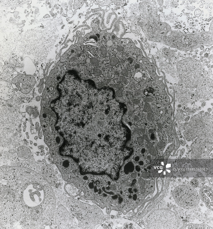 人肿瘤巨噬细胞的TEM图图片素材