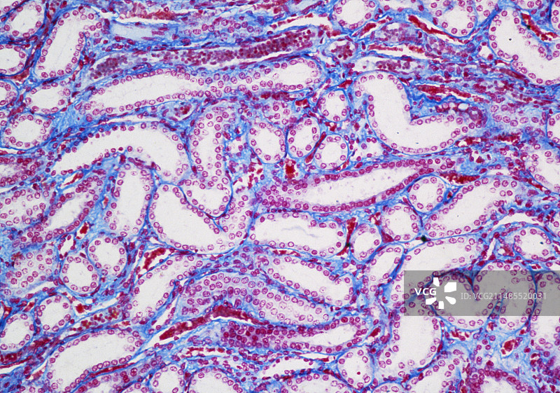 显示肾小管的肾脏图片素材