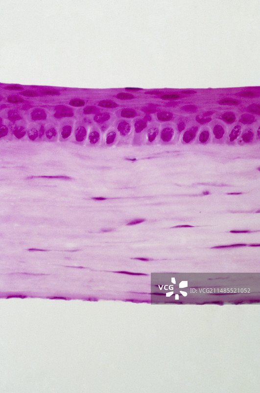 人眼角膜图片素材