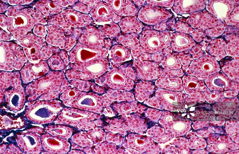 甲状腺光学显微照片图片素材