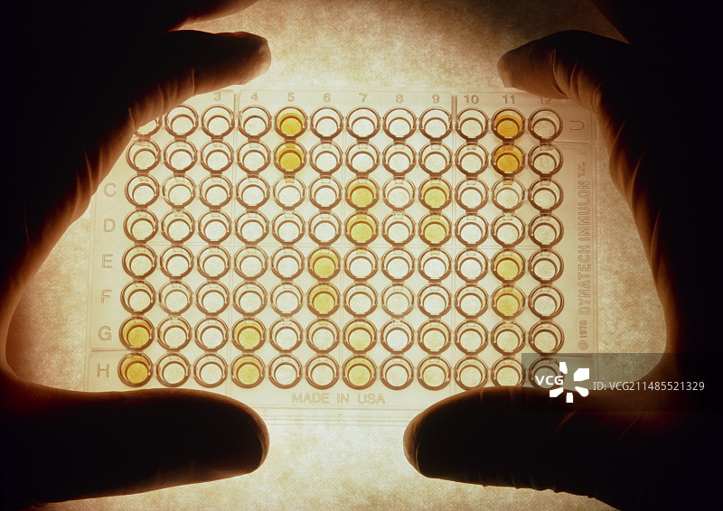 艾滋病病毒ELISA检测图片素材