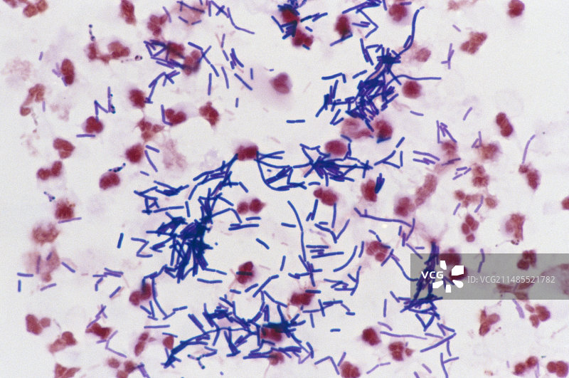 糖尿病妇女阴道涂片的光学显微镜照片：细菌图片素材