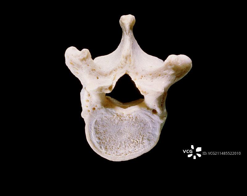 第一腰椎图片素材