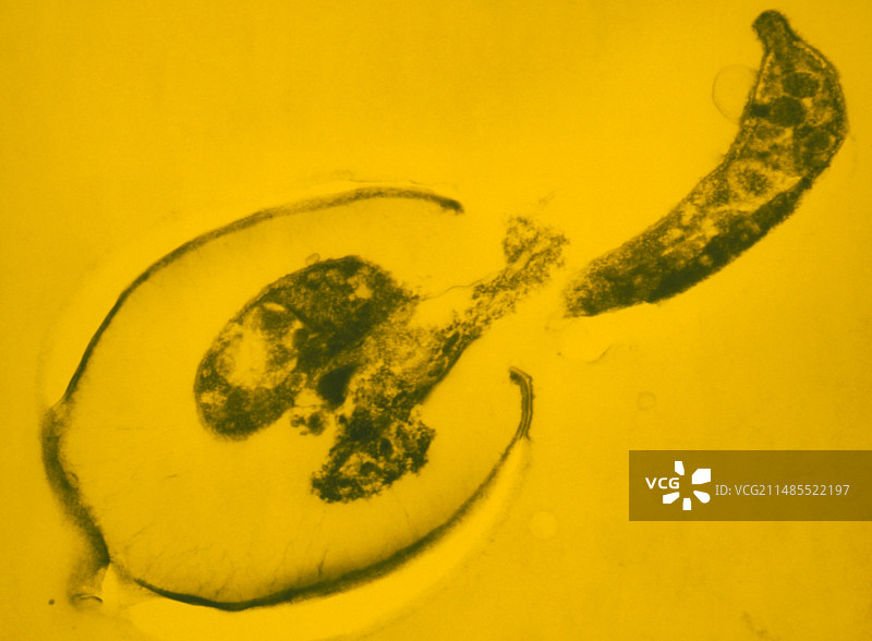 隐孢子虫的伪彩色透射电镜图片素材