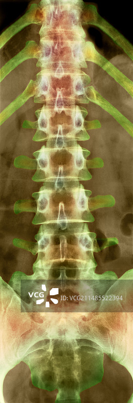 健康的下腰椎X光片。图片素材