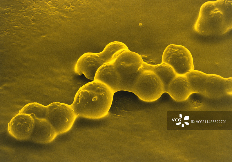 刮擦嗅闻贴纸的伪彩色扫描电镜图图片素材
